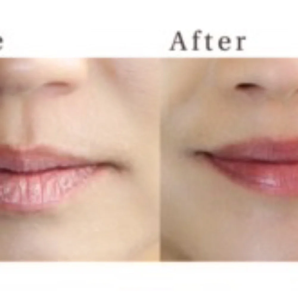 ❤️ NEW! Hanalei Lip Treatment - Picture 5 of 5